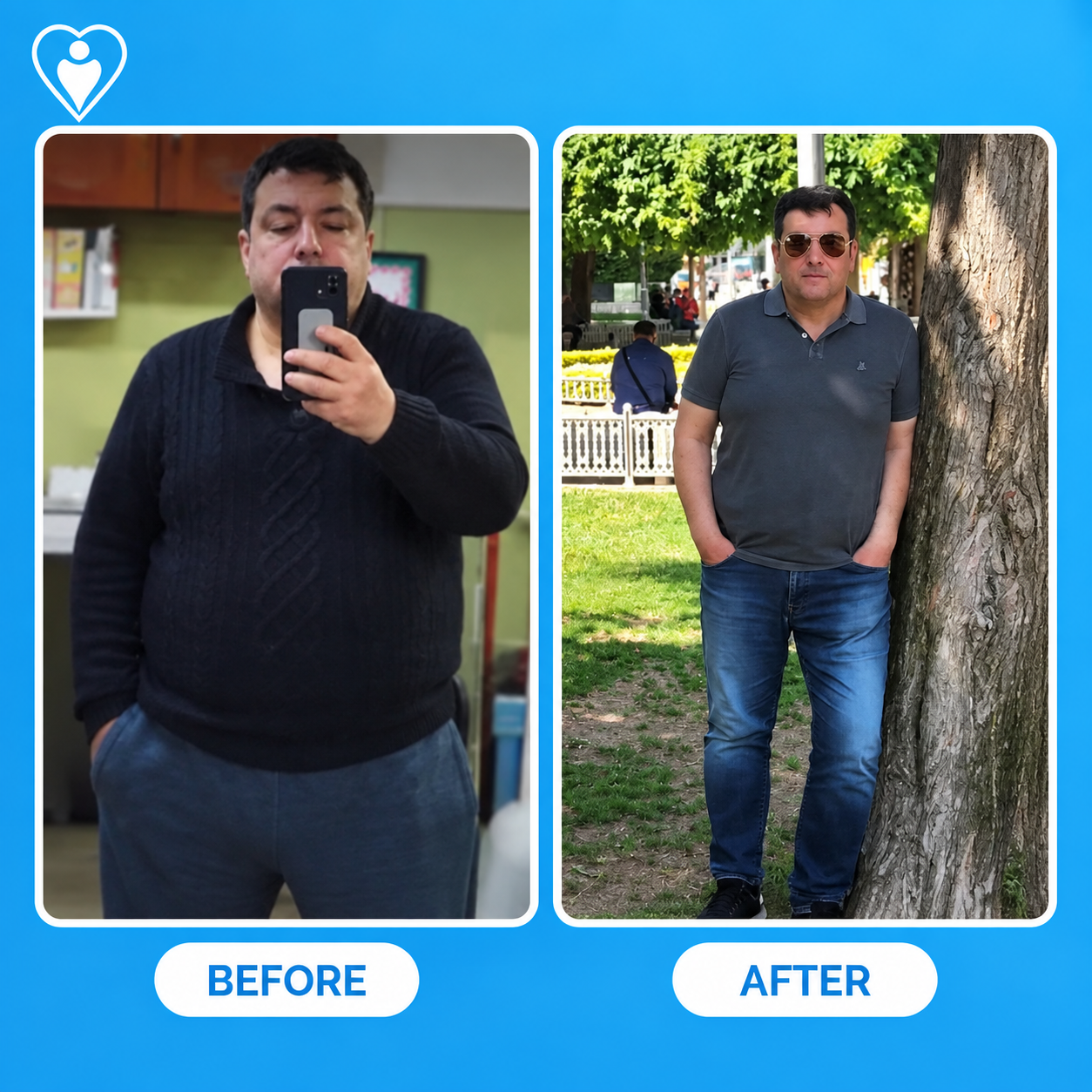 Weight loss surgery before and after: a man before bariatric surgery, and after significant weight loss, patient of Dr. Hasan Liçe, Flymedi.