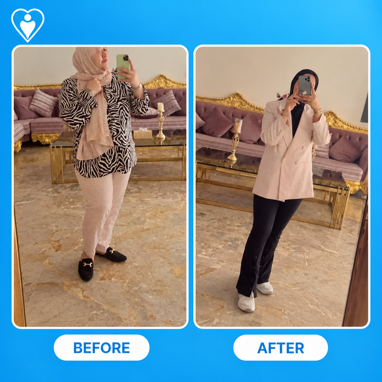 Bariatric surgery before and after: a woman in a hijab before weight loss surgery, and in a blazer after, patient of Dr. Hasan Liçe, Flymedi.