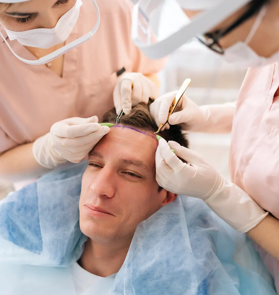 FUE hair transplant in a clinic setting