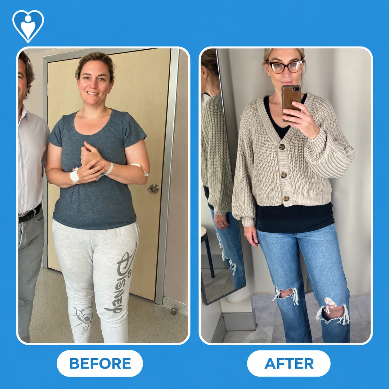 Bariatric surgery before and after: a woman in a t-shirt and sweatpants before, and in a cardigan and jeans after, patient of Op. Dr. İbrahim Karataş, Flymedi.
