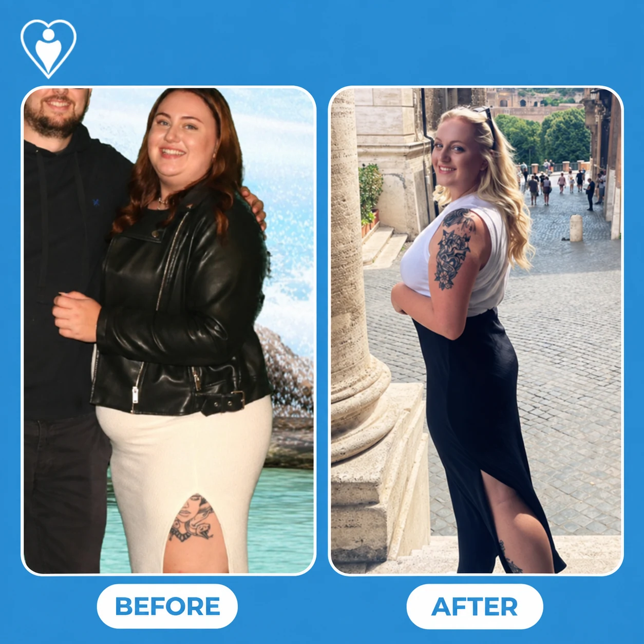 Weight loss surgery before and after: a woman in a leather jacket and white skirt before, and in a white top and long skirt in Rome after, patient of Assoc. Prof. Muhammed Zübeyr Üçüncü, Flymedi.