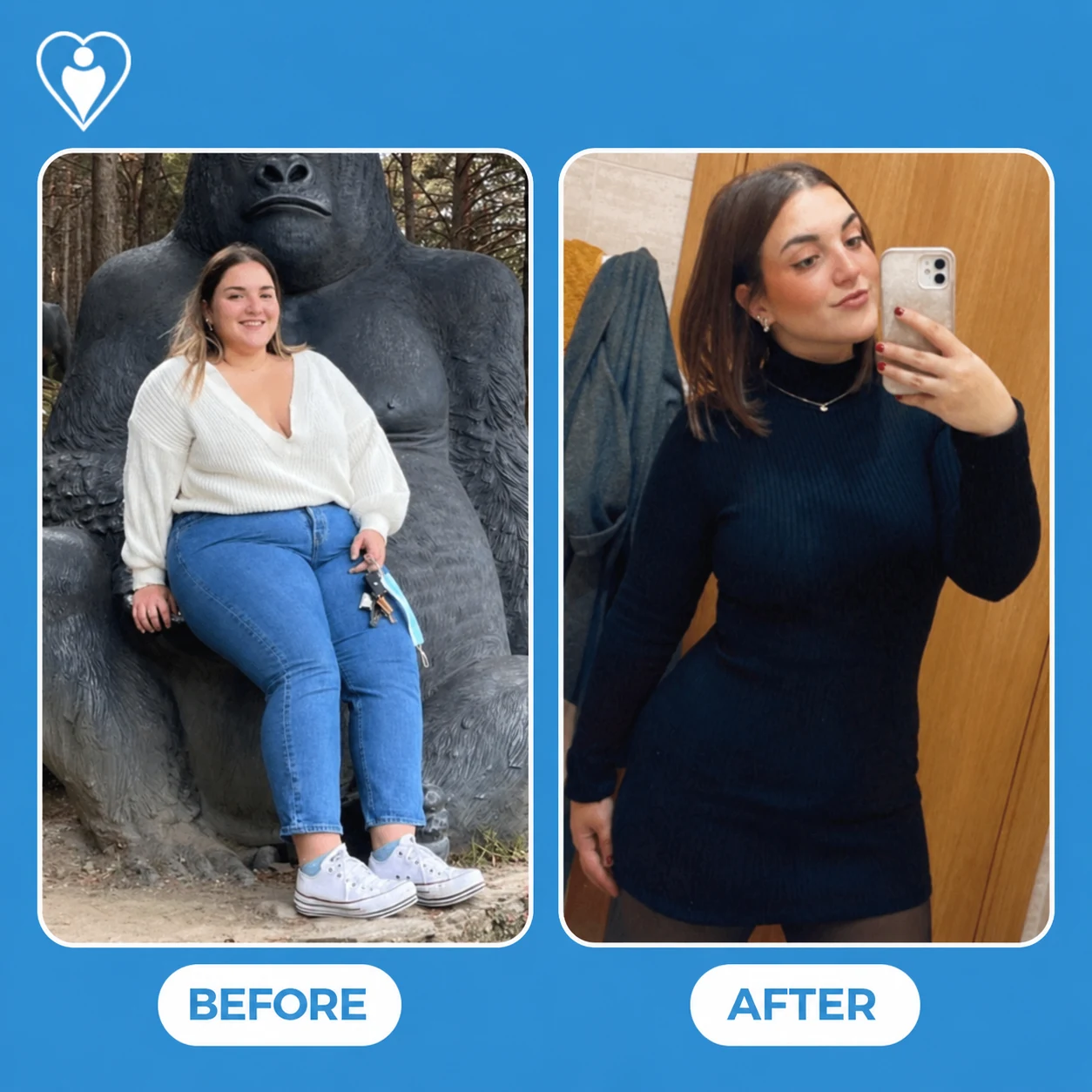 Bariatric surgery results: a woman in a white jumper and jeans before, and in a navy dress in a mirror selfie after, patient of Assoc. Prof. Muhammed Zübeyr Üçüncü, Flymedi.