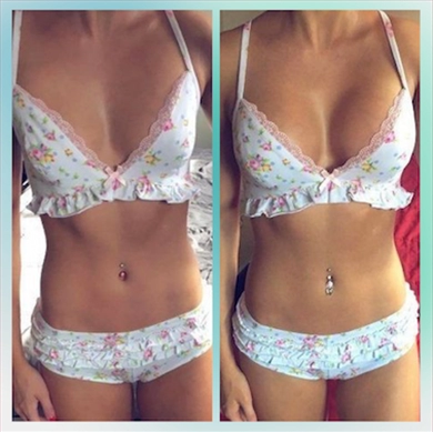 Breast Implants at Luna Clinic Turkey
