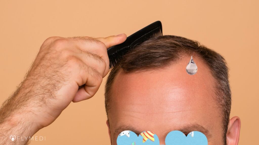 Cover image for Swelling After Hair Transplant: Causes, Timeline, and Relief