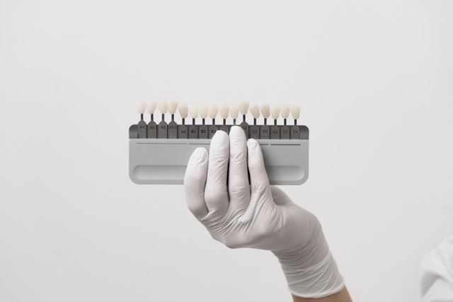 Cover image for Pop-On Veneers: Cost, Reviews, and Are They Worth It? (2026 Guide)